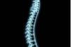 Spine  x ray