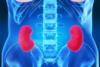Kidney Xray anatomy