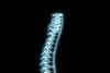 A single spine x-ray