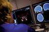 Urgent brain scan for stroke patients
