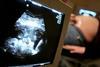 fetal ultrasound pregnancy monitoring