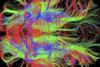 Nerve fibres in human brain