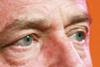 Close crop of Andrew Lansley's eyes to illustrate Lansley's 2010 vision