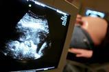 fetal ultrasound pregnancy monitoring
