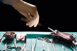 Surgeons hand reaching for scalpel