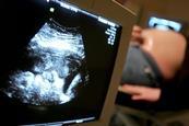 fetal ultrasound pregnancy monitoring