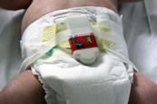 Baby measurement device, attached to a nappy