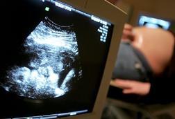 fetal ultrasound pregnancy monitoring