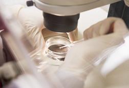 Ivf