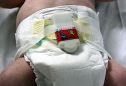 Baby measurement device, attached to a nappy