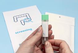 Rectal cancer screening test stock photo
