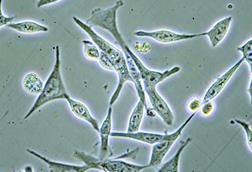 Prostate cancer cells