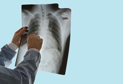Xray