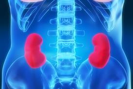 Kidney Xray anatomy