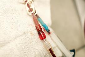 Close-up of cannulas attached to a patient's arm during kidney dialysis.