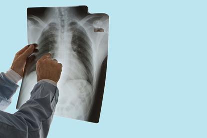 Xray