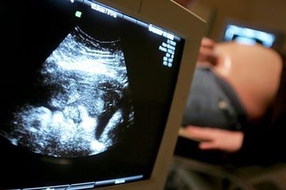 fetal ultrasound pregnancy monitoring