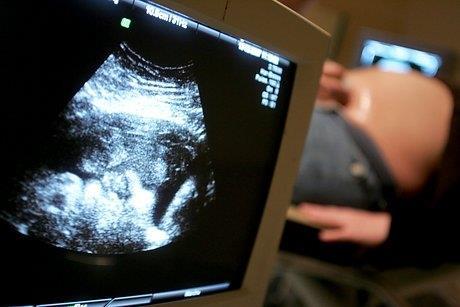 fetal ultrasound pregnancy monitoring
