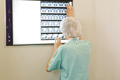 Doctor looking at xray