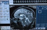 Brain scan