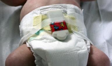 Baby measurement device, attached to a nappy