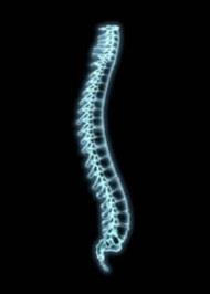 X-ray of spine