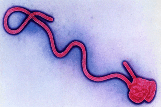 Ebola hemorrhagic fever